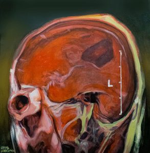 As an artist, I explore the human body using radiological medical studies done to sick, anonymous and genderless people. I like to call the results of my work as "Human Landscapes". This artwork is a portrait of a person with the aforementioned characteristics. As an artist, I explore the human body using radiological medical studies done to sick, anonymous and genderless people. I like to call the results of my work as "Human Landscapes". This artwork is a portrait of a person with the aforementioned characteristics.