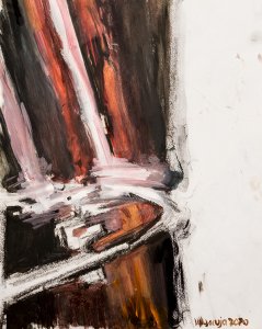 The artwork shows the infiltration of a prosthesis in human flesh that shines like a “crazy diamond”* in the gloom. *Pink Floyd. “Shine On You Crazy Diamond”. 1974. The artwork shows the infiltration of a prosthesis in human flesh that shines like a “crazy diamond”* in the gloom. *Pink Floyd. “Shine On You Crazy Diamond”. 1974.