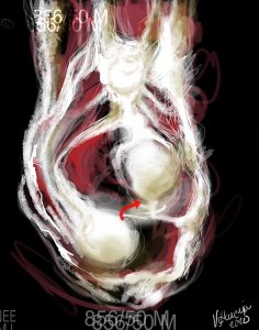 Such as a landscape exposes a blue sky, a flying bird or a tree, this “Human Landscape” displays the sick insides of a human body. It shows my interpretation of a blunted, deformed meniscus. One of my intentions is to grasp its frantic beauty. Such as a landscape exposes a blue sky, a flying bird or a tree, this “Human Landscape” displays the sick insides of a human body. It shows my interpretation of a blunted, deformed meniscus. One of my intentions is to grasp its frantic beauty.