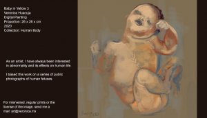 As an artist, I have always been interested in abnormality and its effects on human life. I based this work on a series of public photographs of human fetuses. They stroke my attention because of its composition, colors, dramatic poses and their strange beauty. I made up the work with great respect towards the tragedy of these never born creatures. As an artist, I have always been interested in abnormality and its effects on human life. I based this work on a series of public photographs of human fetuses. They stroke my attention because of its composition, colors, dramatic poses and their strange beauty. I made up the work with great respect towards the tragedy of these never born creatures.