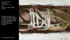 My work has a strong influence of the painter Francis Bacon (1909-1992), who used in some of his works X-ray images made to human bodies. I find this initial resource fascinating and, therefore, I search in nowadays medical imaging to capture the interior of the human body. This artwork explores the interior of a deteriorated human body with an unnatural apparatus that intends to make it recover its functions. The artwork explores the inner “landscape” of a deteriorated body of a Jane or John Doe. It displays an unnatural apparatus incarnated in the flesh that intends to make the body recover its functions.