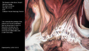 I like to describe the paintings of this collection as “Human Landscapes”. Such as the paint of a tree or a flying bird in the blue sky, this landscape displays the tissues and bones of a deteriorated Jane or John Doe’s body. I like to describe the paintings of this collection as “Human Landscapes”. Such as the painting of a tree or a flying bird in the blue sky, this landscape displays the tissues and bones of a deteriorated Jane or John Doe’s body.