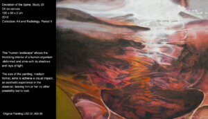 This "human landscape" shows the throbbing interior of a human organism -deformed and alive-with its shadows and rays of light. This "human landscape" shows the throbbing interior of a human organism -deformed and alive-with its shadows and rays of light.