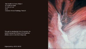 This "human landscape" shows the throbbing interior of a human organism -deformed and alive-with its shadows and rays of light. Through the dazzling light of an X-ray study, the artwork displays the intimacy of the illness that affects a Jane or John Doe’s living body.