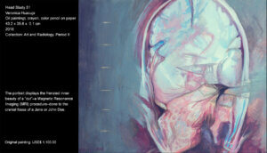 The portrait intends to grab the grotesque beauty of the “cut”–of a Magnetic Resonance Image (MRi)¬–in a Jane or John Doe's cranial fossa. I based this portrait on a coronal view of a Magnetic Resonance Image (MRI). In the artwork, I intend to grab the grotesque beauty of the “cut” in a Jane or John Doe's skull.