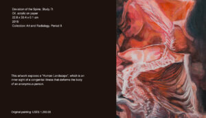 The artwork exposes a “Human Landscape”, which is an inner sight of a congenital illness that deforms the body of an anonymous person. The artwork exposes a “Human Landscape”, which is an inner sight of a congenital illness that deforms the body of an anonymous person.