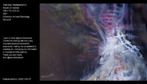 I want to thank @aplombstudioart (Twitter) for sharing with me a very important personal medical life experience, making me comprehend it, inspiring me, and giving me information to recreate it in this painting. I want to thank @aplombstudioart (Twitter) for sharing with me a very important personal medical life experience, making me comprehend it, inspiring me, and giving me information to recreate it in this painting.