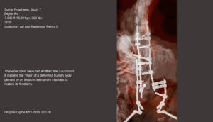 This work could have had another title: Crucifixion. It displays the "map" of a deformed human body pierced by an invasive instrument that tries to restore its functions.