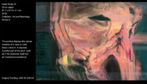 The portrait displays the carnal material of a Jane or John Doe’s cranium. It exposes a partial part of the skull, such as if the character itself has an inconclusive presence. The portrait displays the carnal material of a Jane or John Doe’s cranium. It exposes a partial part of the skull, such as if the character itself has an inconclusive presence.