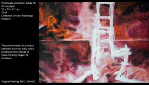 This paint intends to reveal the unnatural junction between a human body-with its flesh and bones-and a prosthesis. The surgical penetration has an obscure side that discloses the human conditions (temporality, pain…).