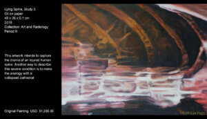 This artwork displays a human torso which–through the tissues, bones and cavities–works like in a system, an organic and a deteriorated one. The medium close-up of the body invites the observer to have an active role, as to feel, and by this, to provoke in him/her an aesthetical experience. This artwork intends to capture the drama of an injured human spine. Another way to describe this severe condition is to make the analogy with a collapsed cathedral.