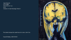 The artwork displays the cranial fossa of a Jane or John Doe. This is, the piece exhibits the carnal material of a genderless, anonymous, sick human body. I based the artwork on radiological coronal “cuts” (front views) medical studies performed on an anonymous person. The artwork displays the cranial fossa of a Jane or John Doe. This is, the piece exhibits the carnal material of a genderless, anonymous, sick human body. I based the artwork on radiological coronal “cuts” (front views) medical studies performed on an anonymous person.