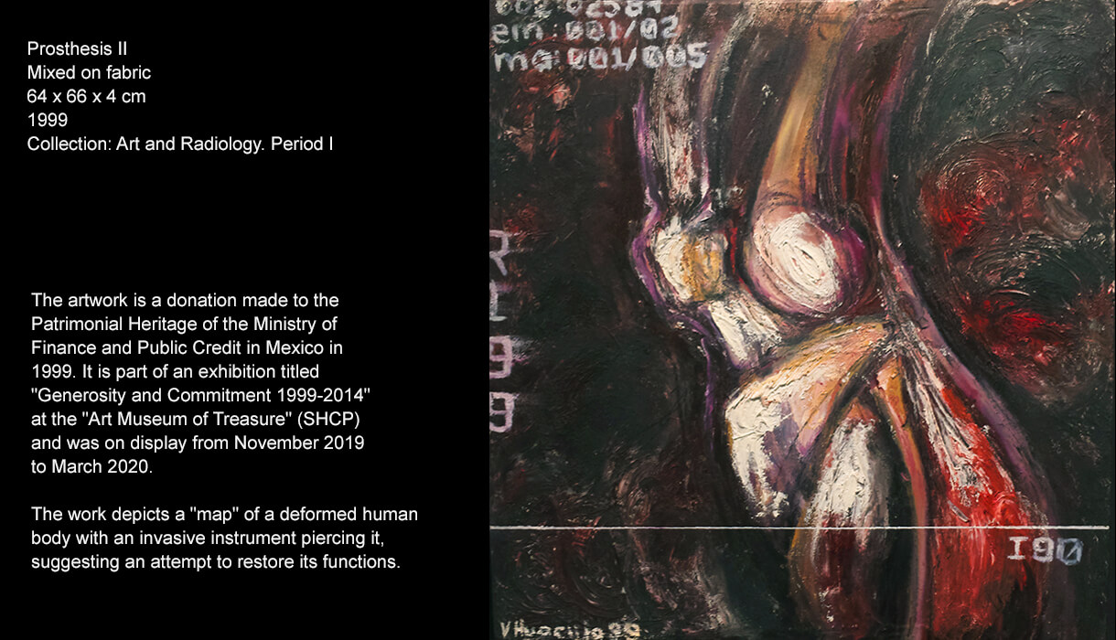 The work depicts a "map" of a deformed human body with an invasive instrument piercing it, suggesting an attempt to restore its functions.