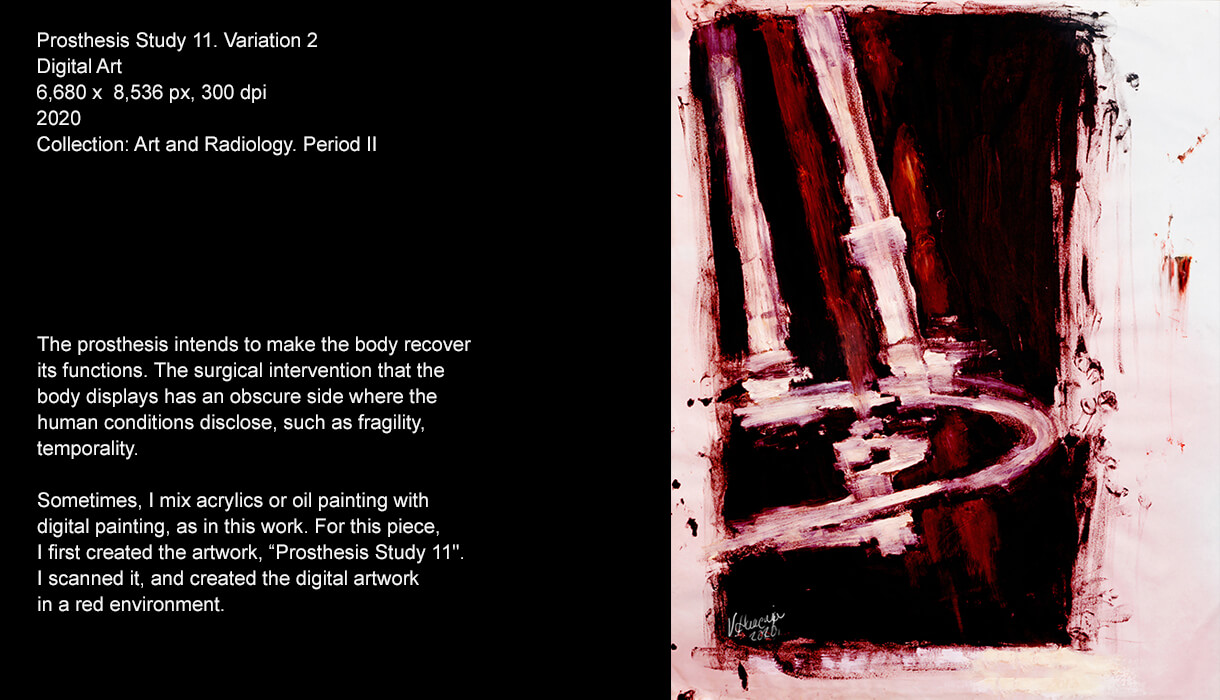 The prosthesis intends to make the body recover its functions. The surgical intervention that the body displays has an obscure side where the human conditions disclose, such as fragility, temporality.