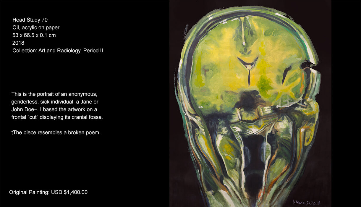 This is the portrait of an anonymous, genderless, sick individual–a Jane or John Doe–. I based the artwork on a frontal “cut” displaying its cranial fossa. The piece resembles a broken poem. This is the portrait of an anonymous, genderless, sick individual–a Jane or John Doe–. I based the artwork on a frontal “cut” displaying its cranial fossa. The piece resembles a broken poem.