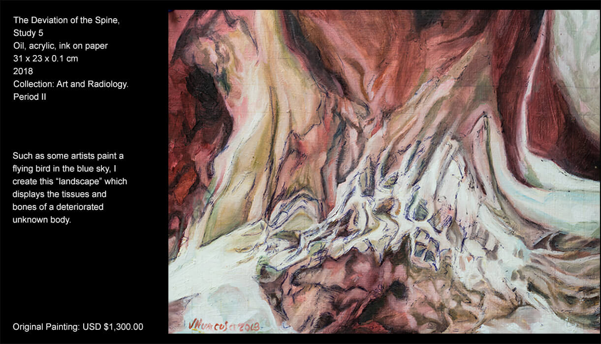 This artwork seeks to capture the throbbing interior of the human body with its shadows and beams of light. As a creator, I tried to grasp the sick, frantic beauty in this human interior exposed by medical imaging. I like to describe the paintings of this collection as “maps” or “human landscapes”. Such as other artists paint a flying bird in the blue sky, I create this “landscape” which displays the tissues and bones of a deteriorated unknown body.