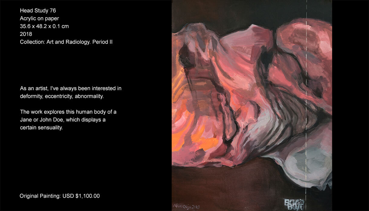 As an artist, I've always been interested in deformity, eccentricity, abnormality. The work explores this human body of a Jane or John Doe, which displays a certain sensuality. As an artist, I've always been interested in deformity, eccentricity, abnormality. The work explores this human body of a Jane or John Doe, which displays a certain sensuality.