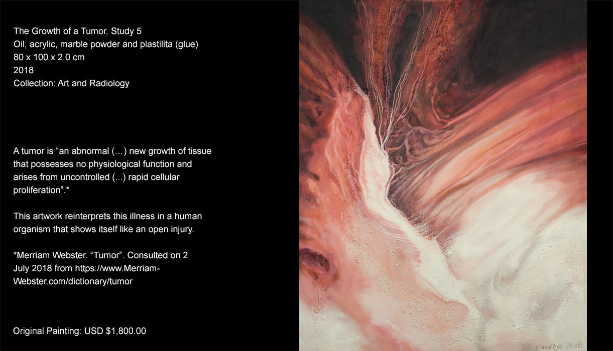 A tumor is an abnormal growth of a tissue that possesses no physiological function and arises from uncontrolledrapid cellular proliferation. This artwork reinterprets this illness in a human organism that shows itself like an open injury. A tumor is an abnormal growth of a tissue that possesses no physiological function and arises from uncontrolledrapid cellular proliferation. This artwork reinterprets this illness in a human organism that shows itself like an open injury.