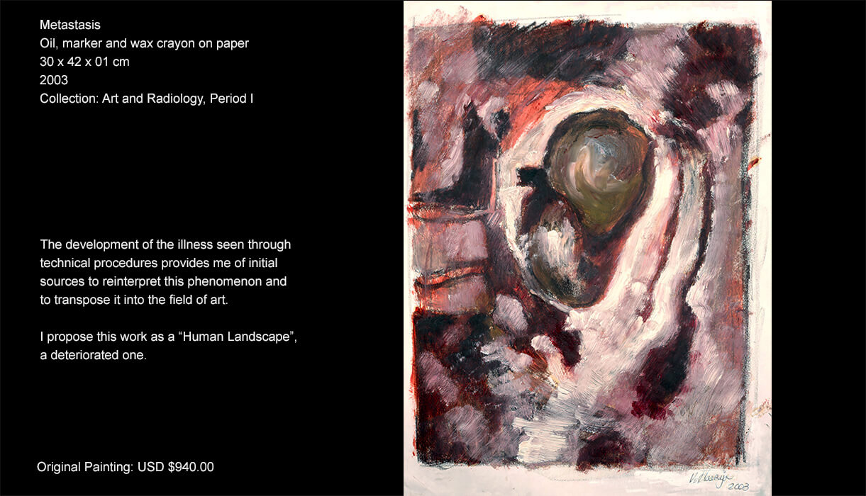 The development of the illness seen through technical procedures provides me of initial sources to reinterpret this phenomenon and to transpose it into the field of art. The development of the illness seen through technical procedures provides me of initial sources to reinterpret this phenomenon and to transpose it into the field of art.
